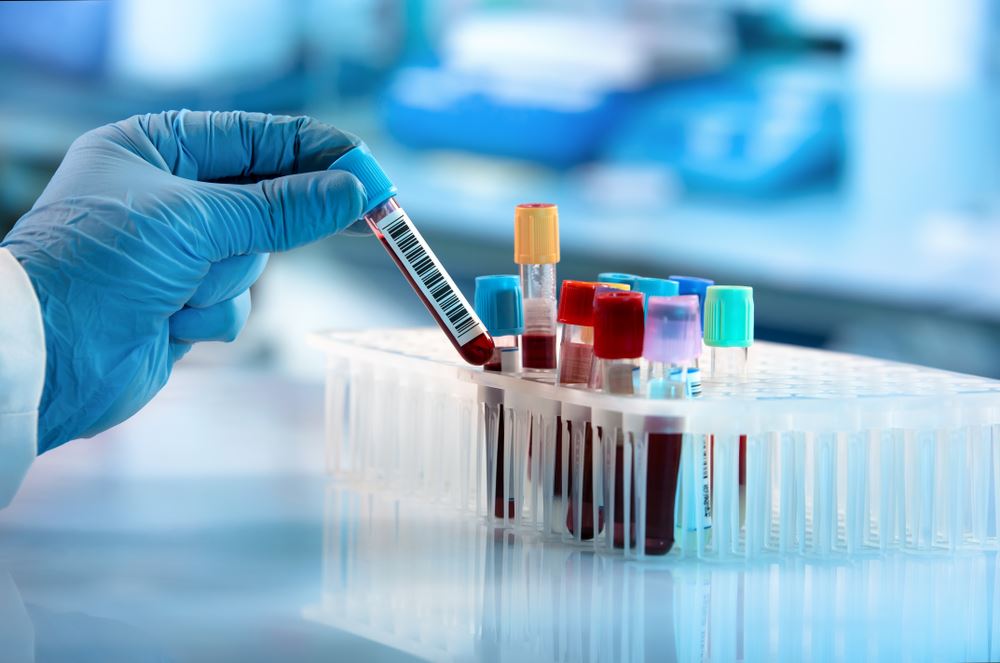 Medvin Labs home blood test service in Bangalore