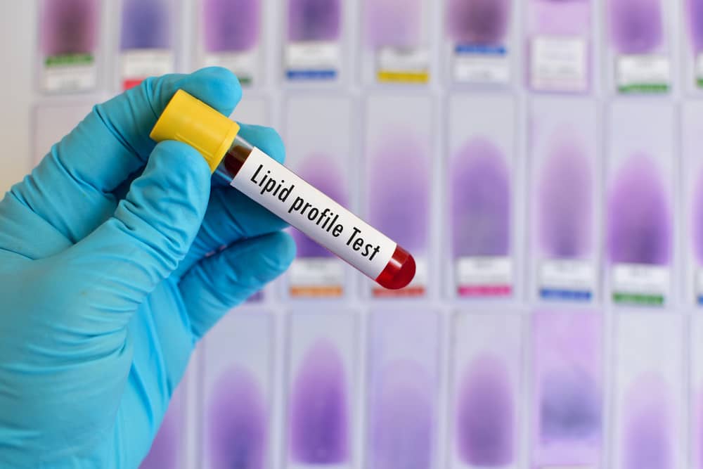 Lipid profile test at home Blood cholesterol Medvinlab