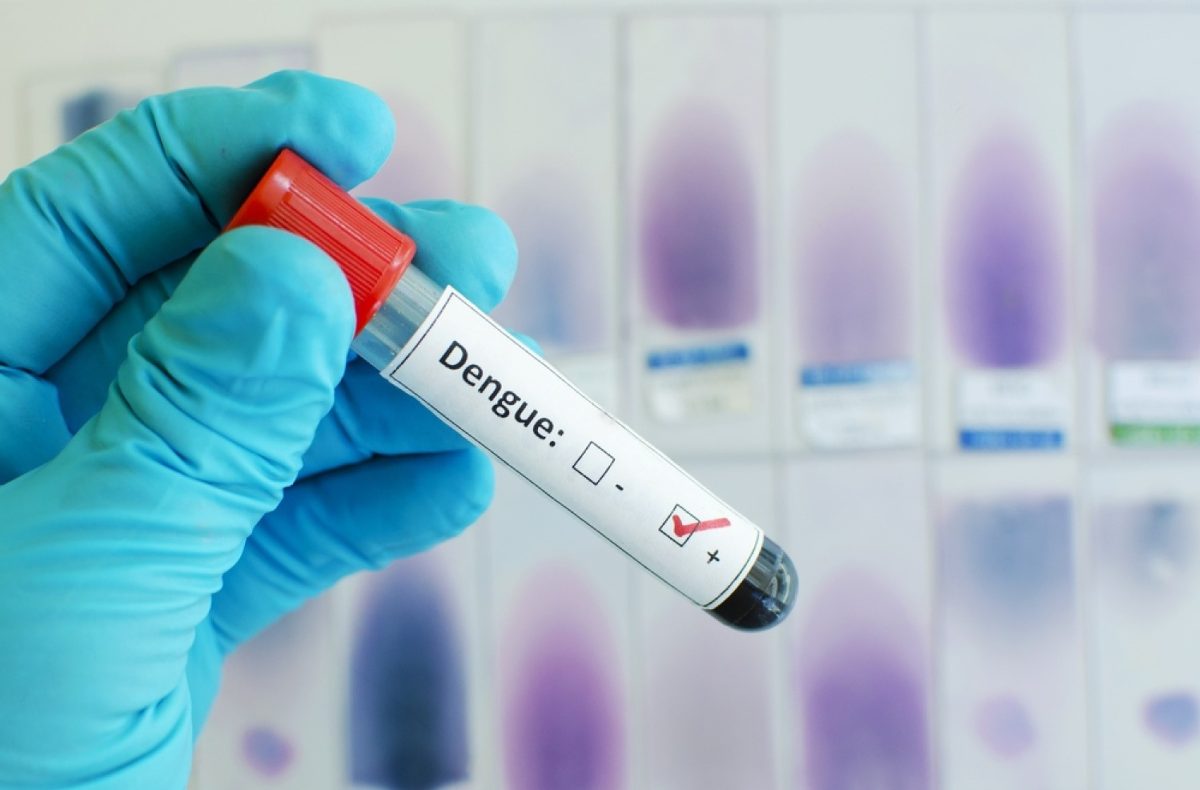 Dengue fever blood test