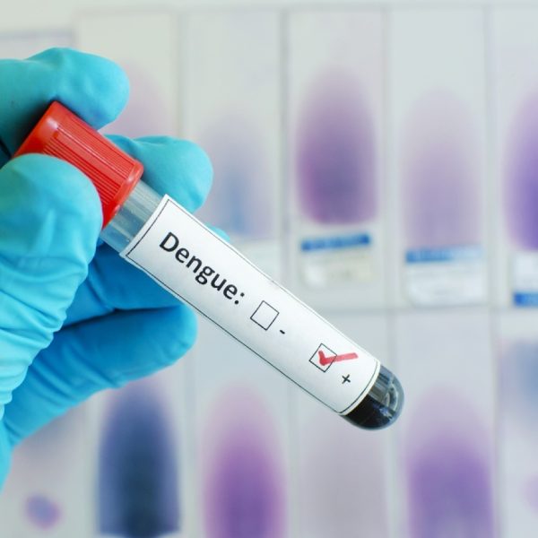 Dengue fever blood test