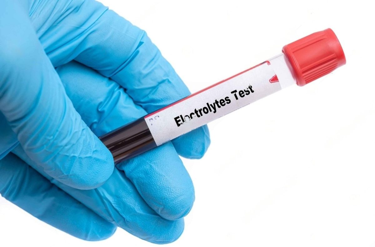 Electrolytes test at home Medvinlab